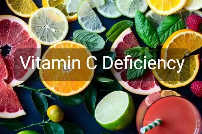 Vitamin C Deficiency – Causes, Symptoms And Treatment